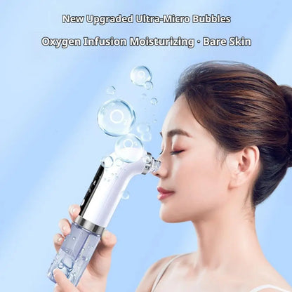 Blackhead Remover Machine, Electric Pore Vacuum, Acne Remover