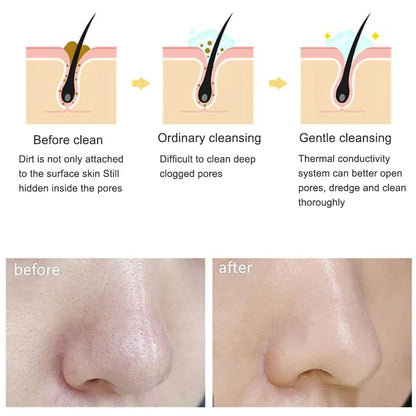 Electric Facial Cleansing Brush Face Skin Care Tools